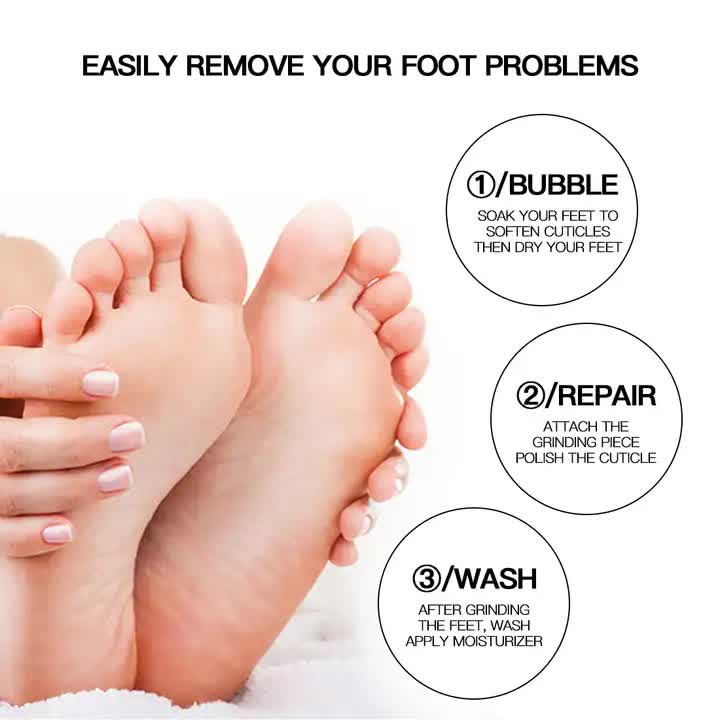 Portable  Electric Foot Callus Remover