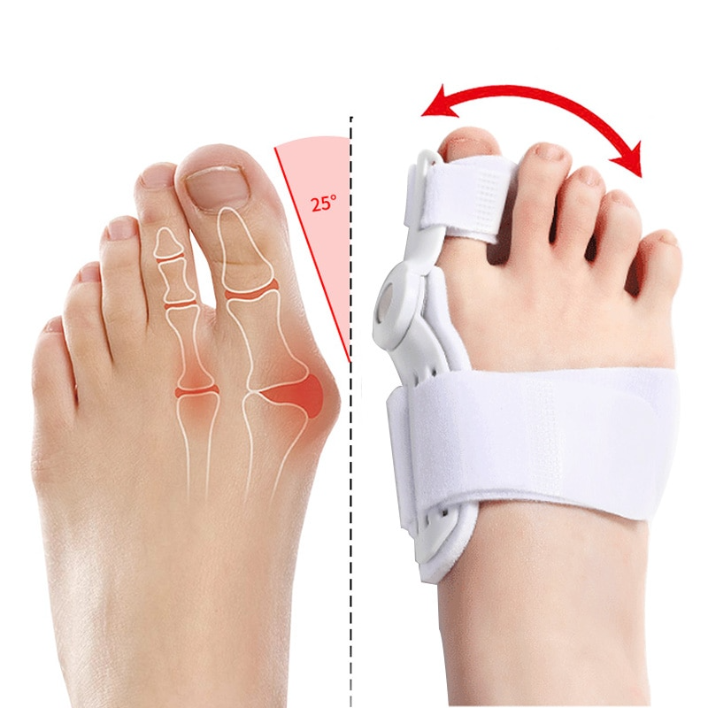 Adjustable Bunion Corrector